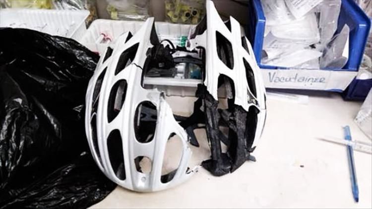 This Is Why You Should Always Wear Your Helmet 23 Pics